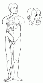 jueyin-liver-meridian-of-foot.gif